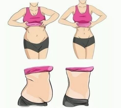 Abdominal loss